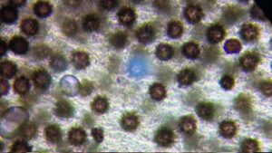 Spores du scleroderma Cepa par vue microscopique
